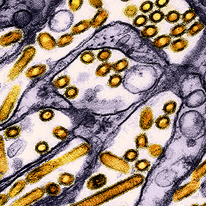 Tissue cross-section shows rod-shaped virus particles in gold among kidney cells in purple