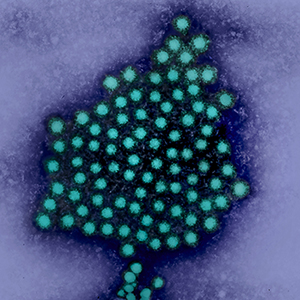 A cluster of round virus particles in teal with dark haloes