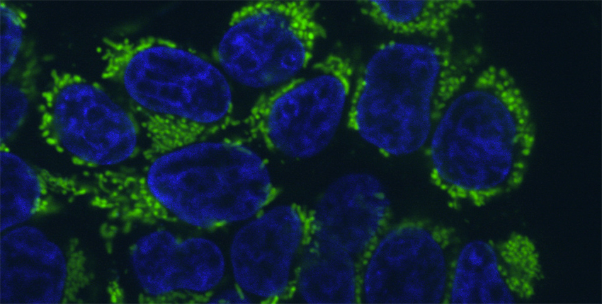 A microscope imaging showing a cluster of round blue shapes surrounded by bright green and black