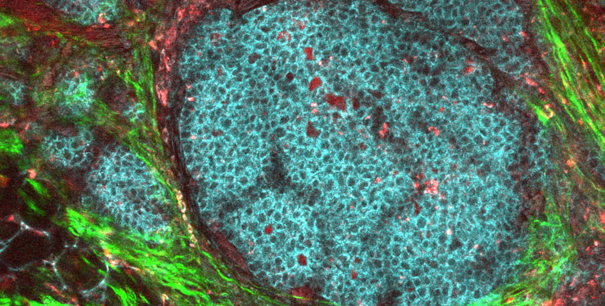 A round cluster of blue cells surrounded by bright green and dark red tissue
