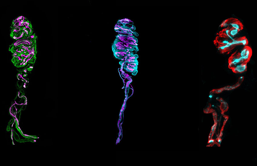 Three vertically oriented, brightly colored, elongated microscopic structures against a black background.