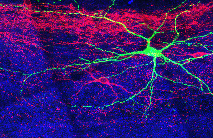 A brightly colored image showing branching magenta and green neurons on a blue background