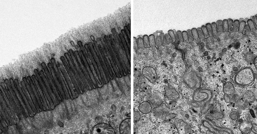 Side-by-side black-and-white scanning electron microscope images of epithelial cells. On the left, villi are long and dark. On the right, they are about one-third to one-quarter as long.