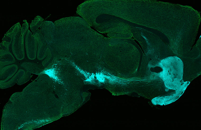 Cross-section of a brain under a microscope shows tiny green dots scattered at high concentration throughout, as well as cyan dots concentrated in three or four regions.