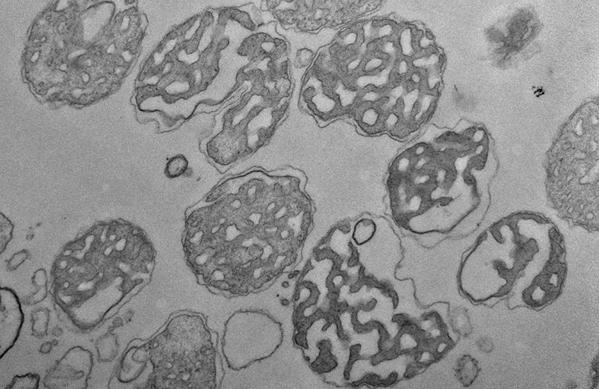Grayscale microscopy shows about 10 mitochondria shaped like walnuts or brains
