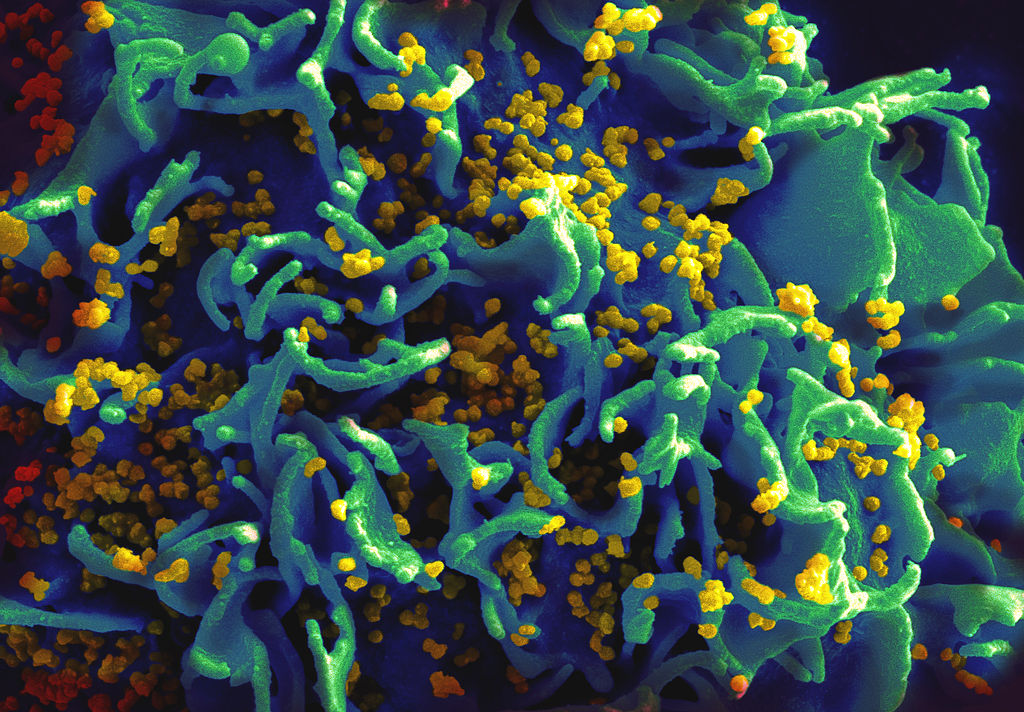 HIV Vaccine Takes Big Step