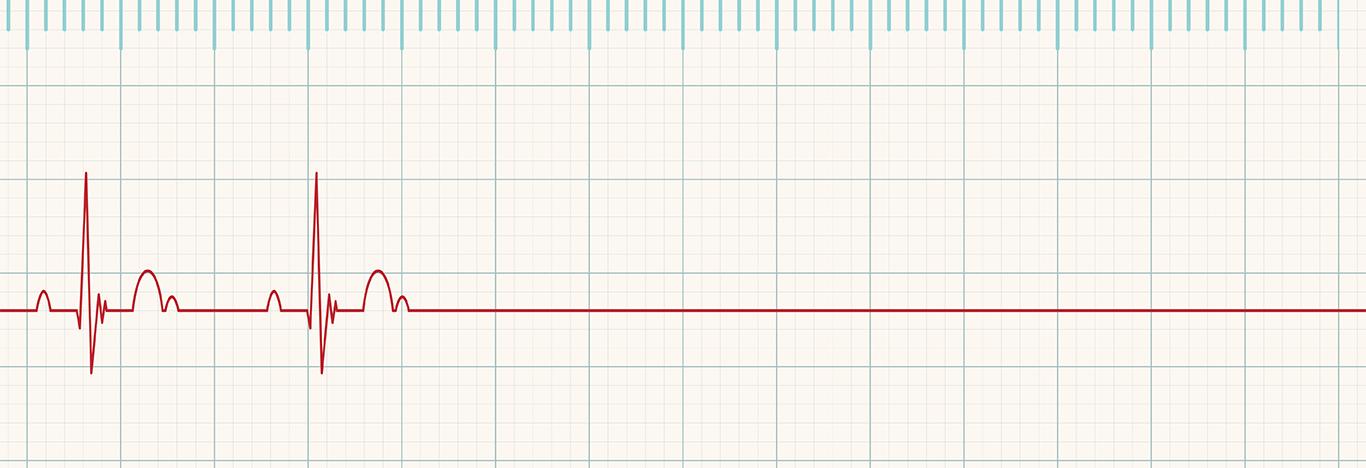 A Fine Line