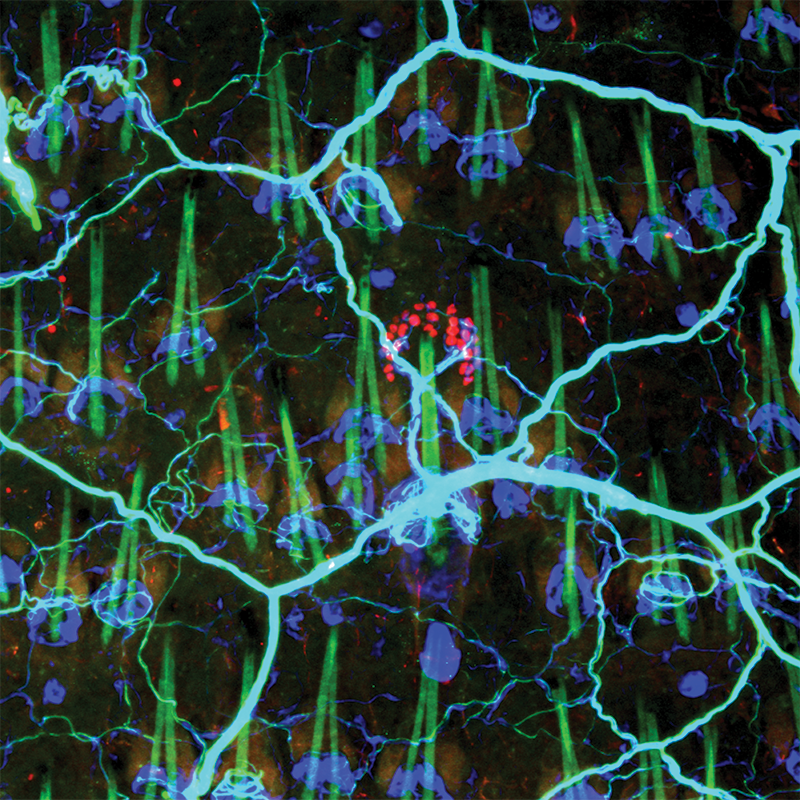 network of sensory neurons in mouse skin