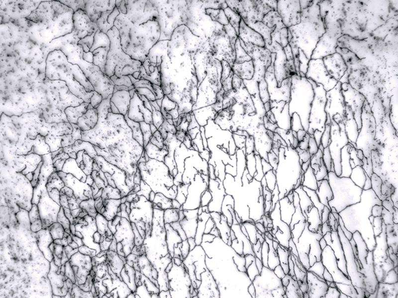 single-labeled neuron in hairy skin