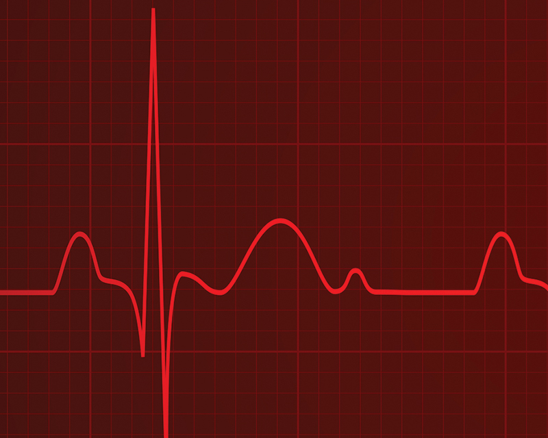 cardiogram graphic