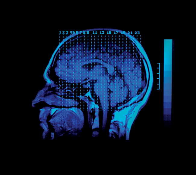 MRI of a human head
