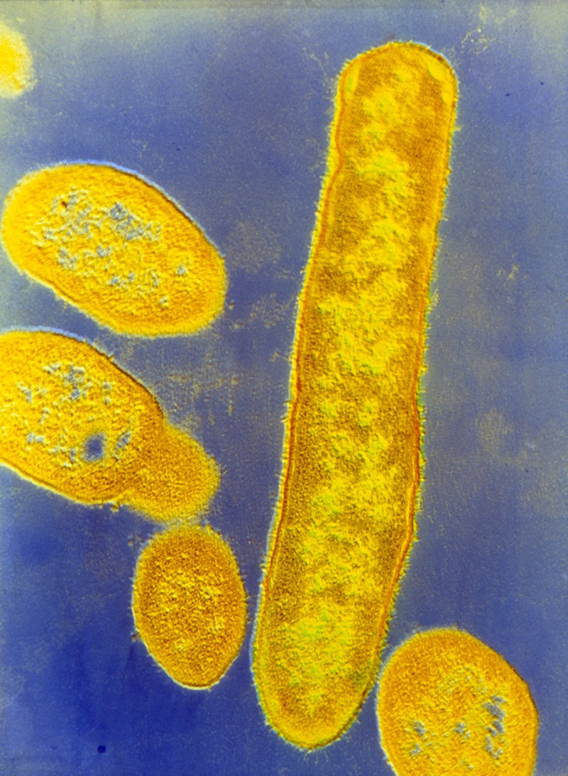Colorized micrograph of Bacteroides fragilis