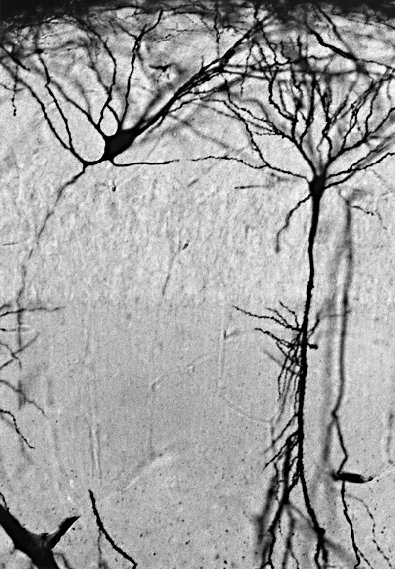 Light micrograph of an interneuron and a pyramidal neuron