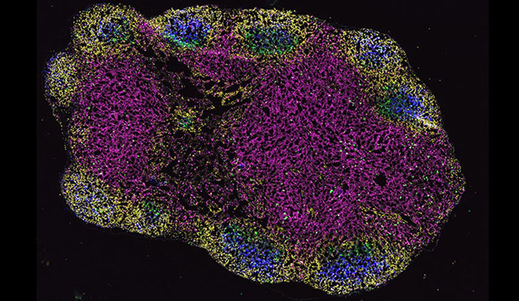 different cell types are fluorescently tagged different colors in a blob-shaped lymph node seen under a microscope