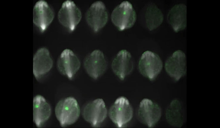 heart cells labeled with green fluorescent protein