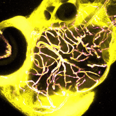 A yellow and black zebrafish brain