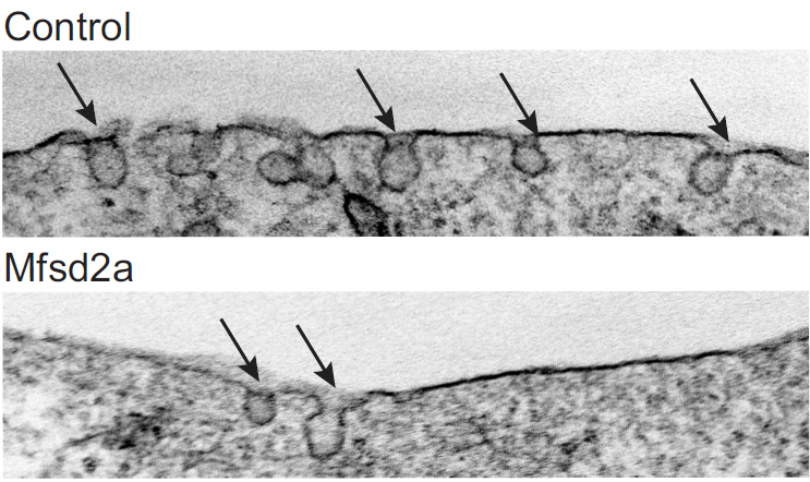 Endothelial cells without Mfsd2a (top) have higher rates of caveolae vesicle formation, compared to cells with Mfsd2a (bottom). Image: Gu lab