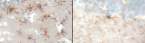 Microglia counter amyloid. In mice that produce human amyloid precursor protein, microglia (dark brown) infiltrate the brain (left). When the microglial chemokine receptor Ccr2 is ablated, cellular migration is blocked (right) and pathology is exacerbated. Courtesy Joseph El Khoury.