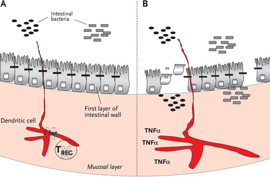 Losing the peace. In colonic dendritic cells, the transcription factor T-bet helps suppress inflammation, a new study shows. Dendritic cells sample bacteria in the lumen (A). In mice missing T and B cells that also lack T-bet, the dendritic cells react to bacteria by releasing excessive amounts of TNF-alpha (B). The cytokine kills epithelial cells, somehow turning the resident bacteria pathogenic. Antibiotics, T regulatory (Treg) cells, and TNF-alpha antagonists reversed the condition in mouse experiments. Watch a slide demonstration and listen to the researchers explain their work and its implications online. Wendy Garrett/Rachel Eastwood 