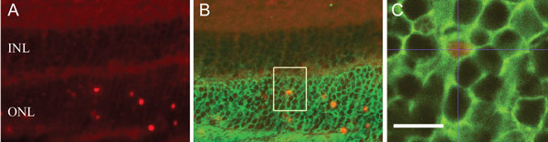 Second sight. Retinal progenitor cells differentiated into mature photoreceptor cells three weeks after aminoadipate treatment. Confocal images of retinal sections taken from an adult mouse at 21 days after aminoadipate treatment show (A) that proliferating progenitor cells (red, anti-BrdU) have migrated out of the inner nuclear layer (INL) to the outer nuclear layer (ONL) and (B and C) colocalize with immunostaining for the mature photoreceptor cell marker rhodopsin (green). Courtesy Dong Feng Chen.