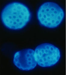 With additional Sirtuin proteins added, these yeast cells enjoy greater longevity. Image by Philipp Oberdoerffer.