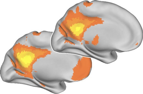 Brain drain. Separate brain regions show correlated activity in young adults (background image). But in advanced aging, coordinated activity among brain regions decreases and accompanies cognitive decline (foreground). Courtesy Jessica R. Andrews-Hanna.