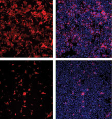 In the top panels, HIV (red) infects cultured human cells (cellular DNA is stained blue). In the bottom panels, HIV levels are lower, as researchers interfered with the production of a host protein called TNPO3.