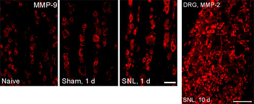 Enzyme ups and downs. Immunohistochemical staining shows that the matrix metalloprotease MMP-9 is rapidly upregulated within dorsal root ganglion (DRG) neurons of rats with spinal nerve damage (SNL, 1d), but not in naive or sham animals. MMP-2 is upregulated later in glial cells within the DRG of rats with spinal nerve damage (SNL, 10d). Courtesy Ru-Rong Ji.