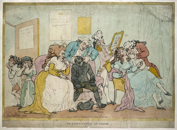 The English caricaturist Thomas Rowlandson shows healthy teeth being extracted from the poor to create dentures for the wealthy. Courtesy Wellcome Library, London.