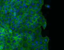 The team's interactive database includes images and movies of human breast cells such as these repairing wounds.
