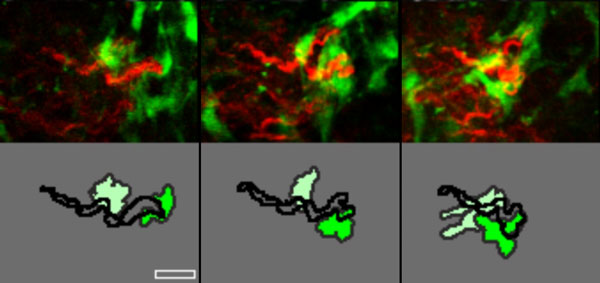 Web of life. The dragging of a collagen fiber by two overlapping fibroblasts appears (from left) at one, three, and nine days. The drama is revealed in the top panel, which merges two techniques, second harmonic generation (red) and green fluorescent protein. A schematic of the interaction between the collagen fiber (black) and fibroblasts appears in the bottom panel. Courtesy Nature Methods and Yves Boucher.