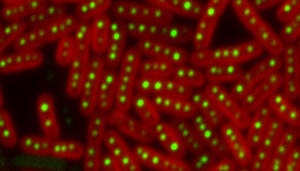 Cyanobacteria lacking the parA protein create varied numbers of carboxysomes and space them unevenly. Courtesy of Bruno Afonso and David F. Savage.