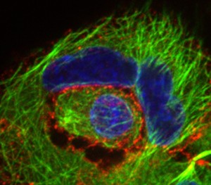 In entosis, one living cell enters another, often disrupting division of that host cell. In this photomicrograph, the host cell has two nuclei, stained in blue. Immunostaining reveals, in green, alpha-tubulin, a protein component of a cell’s cytoskeleton; and, in red, E-cadherin, a protein important in cell adhesion. 