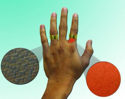 In this illustration, a nanoparticle cream applied to the ring finger prevents inflammation from the nickel in a ring (brownish particles represent a thin barrier layer of nanoparticles). The forefinger, without the cream, is inflamed after exposure to the ring and its nickel. Illustration by Praveen Kumar Vemula, Karp lab, BWH.