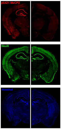 The right-hand column depicts images of a brain for which a gene important for sensing environmental experience has been altered, compared with a normal brain on the left. While the blue and green images show that the number and pattern of nerve cells is similar between the normal and mutant brains, the red image shows that in the mutant mouse this environmental-stimuli gene can no longer respond to experience. Image by Harrison Gabel