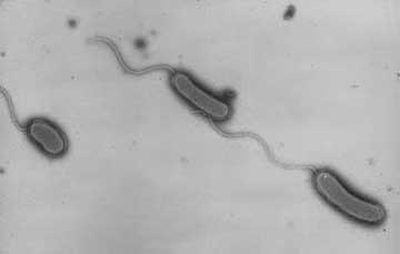 Cholera bacterium.  Photo courtesy John Mekalanos, Adele Lehman Professor of Microbiology and Molecular Genetics and chair of the HMS Department of Microbiology and Immunobiology 