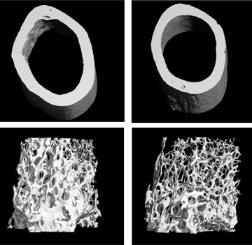 A CT scan of a normal femur (top and bottom left) compared to one without VEGF (top and bottom right). Bone thickness and density is significantly reduced. Image courtesy of Olsen lab.