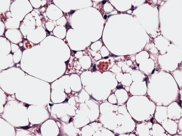 The cells here with multiple globules are beige fat cells and burn off calories rather than storing them, as white fat cells do. Courtesy of Bruce Spiegelman and Jun Wu/DFCI