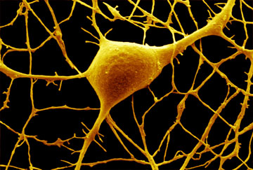 Purkinje nerve cell, DAVID MCCARTHY/SCIENCE PHOTO LIBRARY