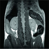 Non-invasive visualization of a mouse by Magnetic Resonance Imaging with a 4.7-Tesla microimaging system. Courtesy Ralph Weissleder.