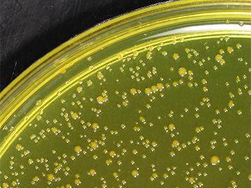 There may be much more genetic diversity within a single species of bacteria in an infected person than previously assumed. Image: Tami Lieberman