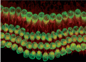 In a normal cochlea, three outer rows of hair cells and one inner row can be seen. Image courtesy Albert Edge/Mass. Eye and Ear