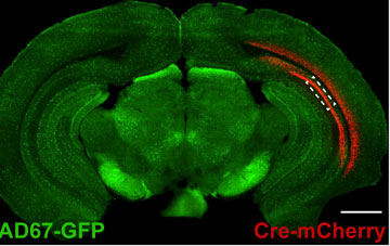 In this coronal section of a mouse brain, inhibitory neurons express green fluorescent protein. Neurons expressing red manifest deregulated mTOR, which triggers loss of inhibitory currents, leading to seizures. Image courtesy of Sabatini lab