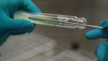 A biologist in Lima, Peru cultivates mycobacterium tuberculosis for drug susceptibility testing. Photo by Joshua Mitnick.
