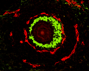 Nerve (green) and blood vessel (red) form a distinctive double ring around the whisker follicle of a developing mouse. Image: Won-Jong Oh 
