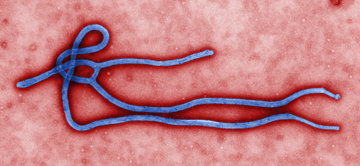 Ebola virus. Image: CDC