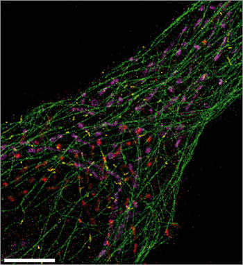 This ultrasharp Exchange-PAINT image simultaneously spots microtubules (green), mitochondria (purple), Golgi apparatus (red), and peroxisomes (yellow) from a single human cell. Image: Maier Avendano/Wyss Institute