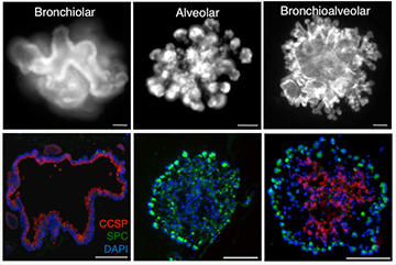 Researchers have coaxed bronchioalveolar stem cells to produce colonies containing bronchiolar epithelial cells, alveolar epithelial cells or both. Image: Joo-Hyeon Lee