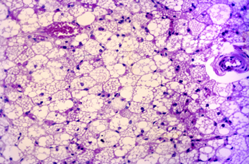 Light micrograph showing brown adipose tissue. Image: Biophoto Associates/Science Source