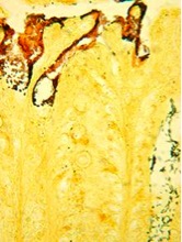 Citrobacter rodentium bacterial cells (reddish-brown) reside alongside commensal flora (black rods) in the colon. Image courtesy of Bry laboratory.